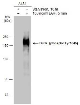 Western Blot: EGFR [p Tyr1045] Antibody [NBP3-13229]